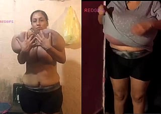 Wow, This Lady Has Some Serious Boobs!: True Macromastia'